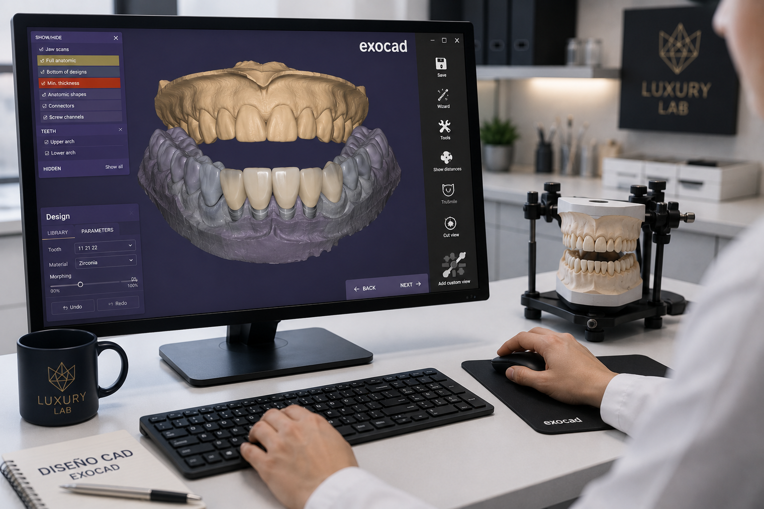 Diseño dental CAD/CAM en Exocad de una restauración realizada por Luxury Lab
